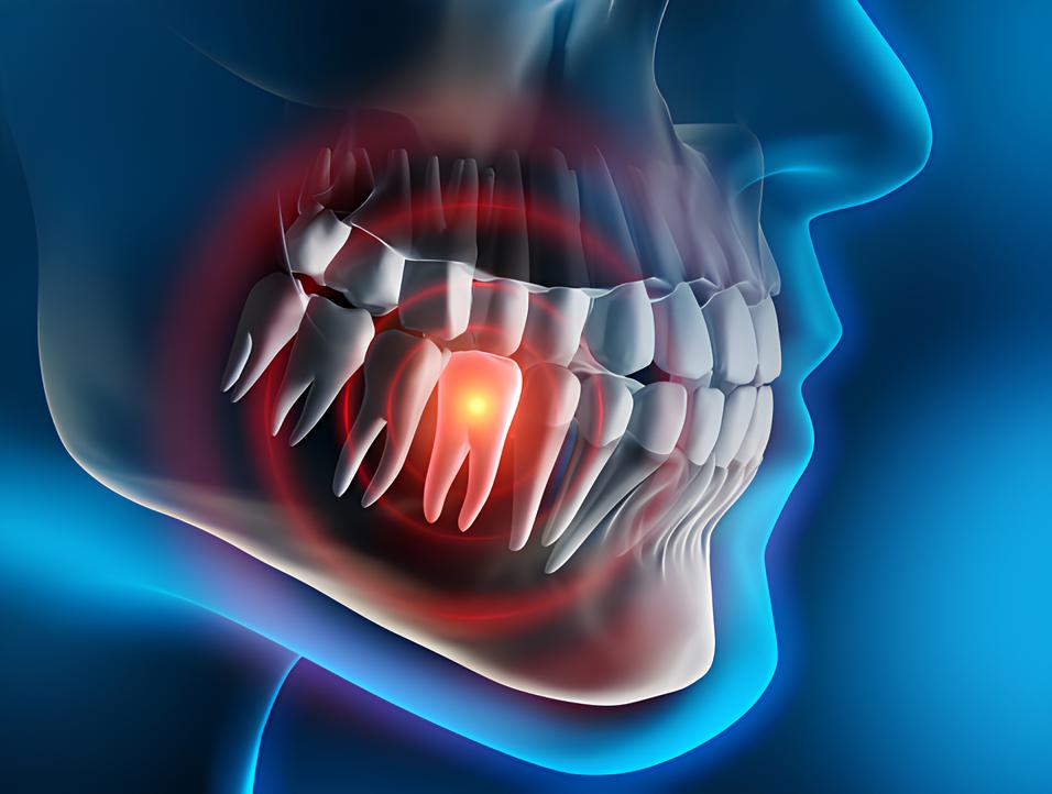 Teeth image - Emergency dentist Kings Langley